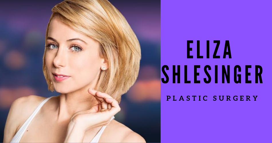 Iliza Shlesinger Plastic Surgery